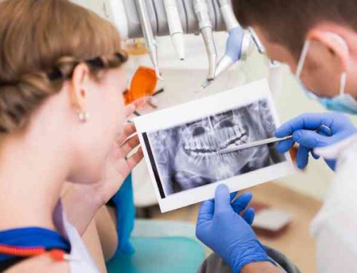 Are Dental Implants Right for You?